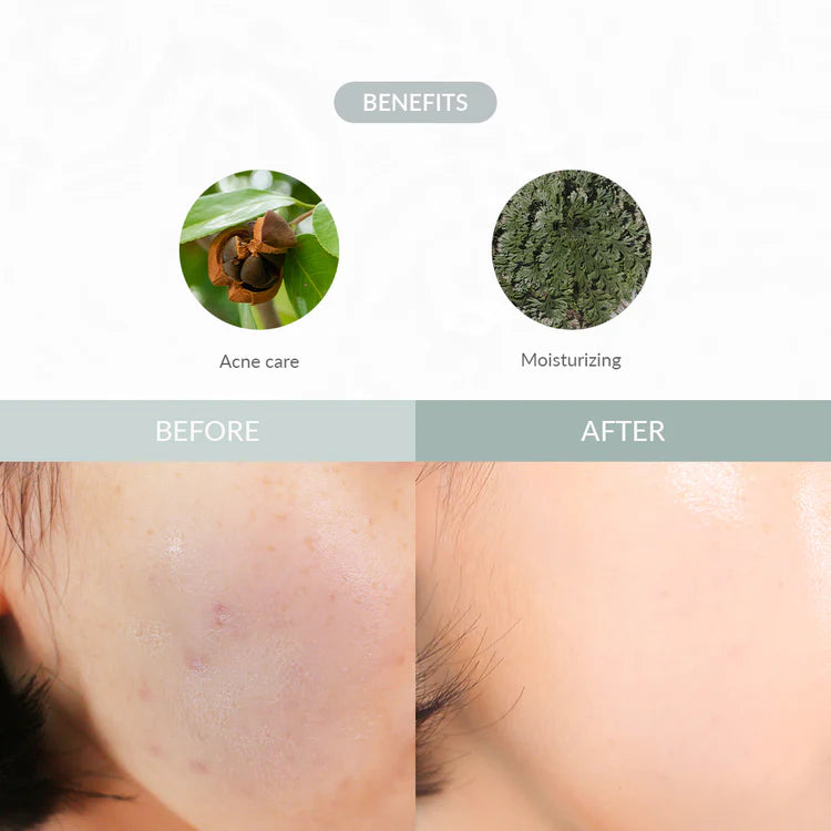 Dr. Althea - Last Minute Skin Rescue Anastatica Mask (30 stk)