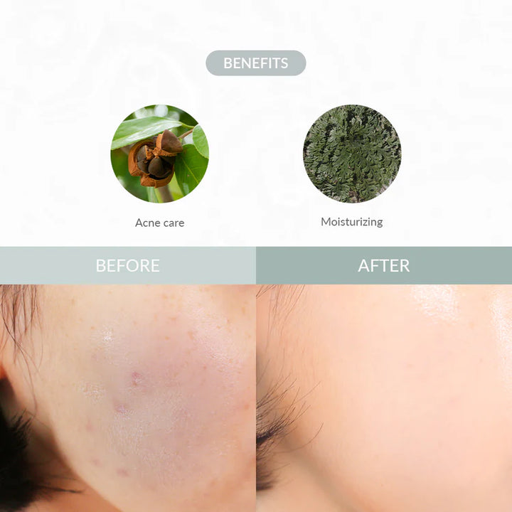 Dr. Althea - Last Minute Skin Rescue Anastatica Mask (30 stk)