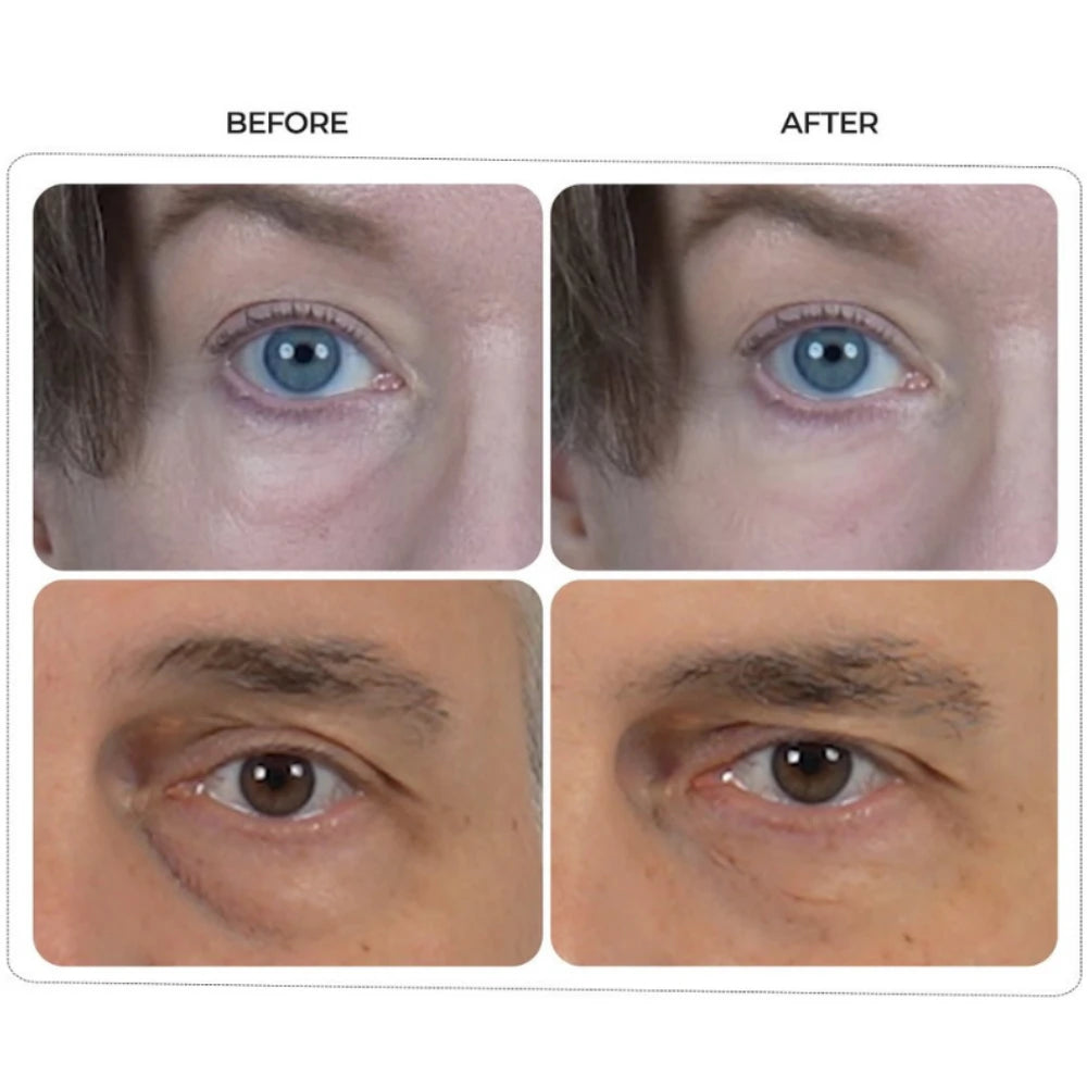 Dr. Melaxin - Eyephalt Eyebag Cream