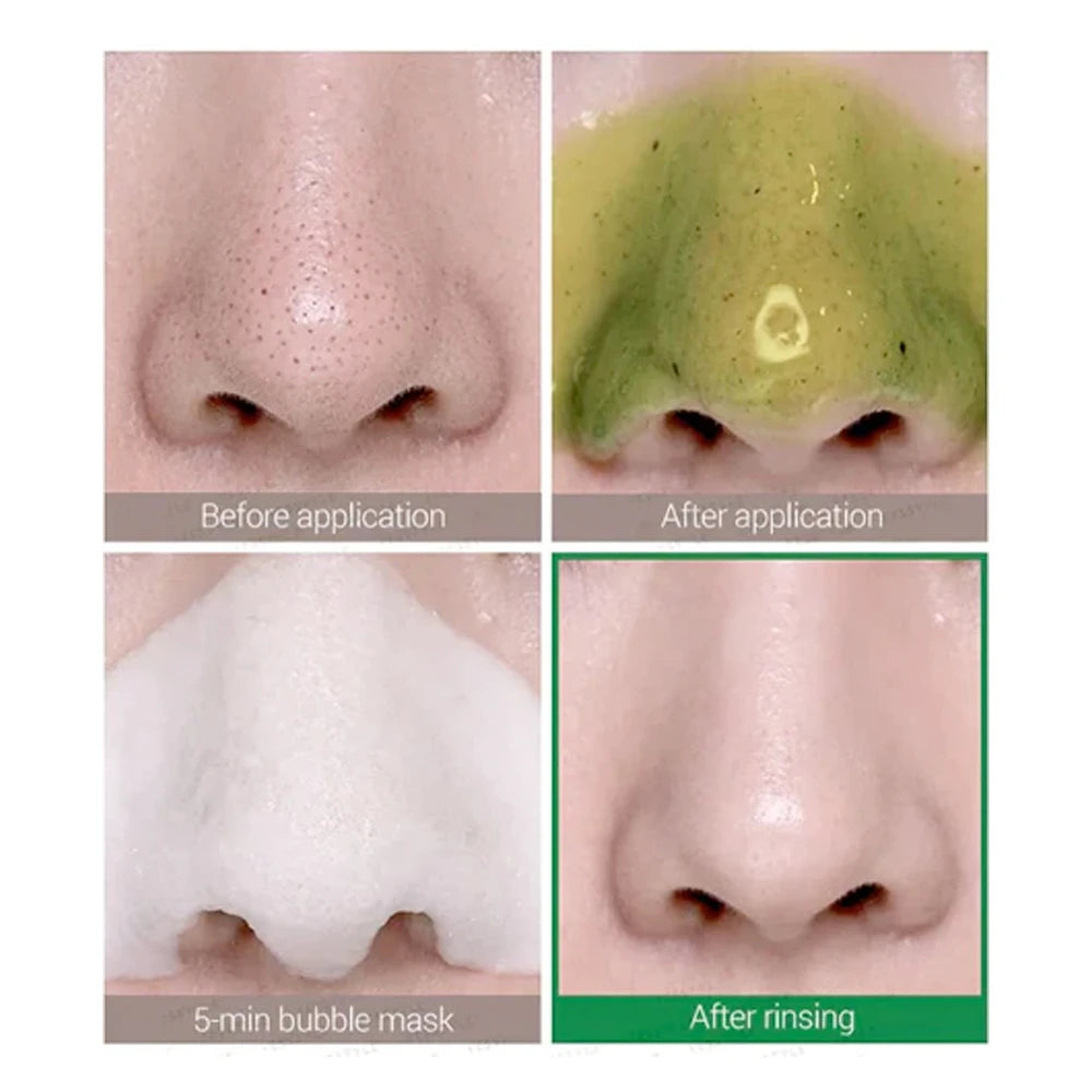 Some By Mi - Bye Bye Blackhead 30 Days Bubble Cleanser (120 ml.)