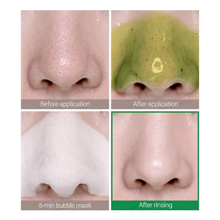 Some By Mi - Bye Bye Blackhead 30 Days Bubble Cleanser (120 ml.)