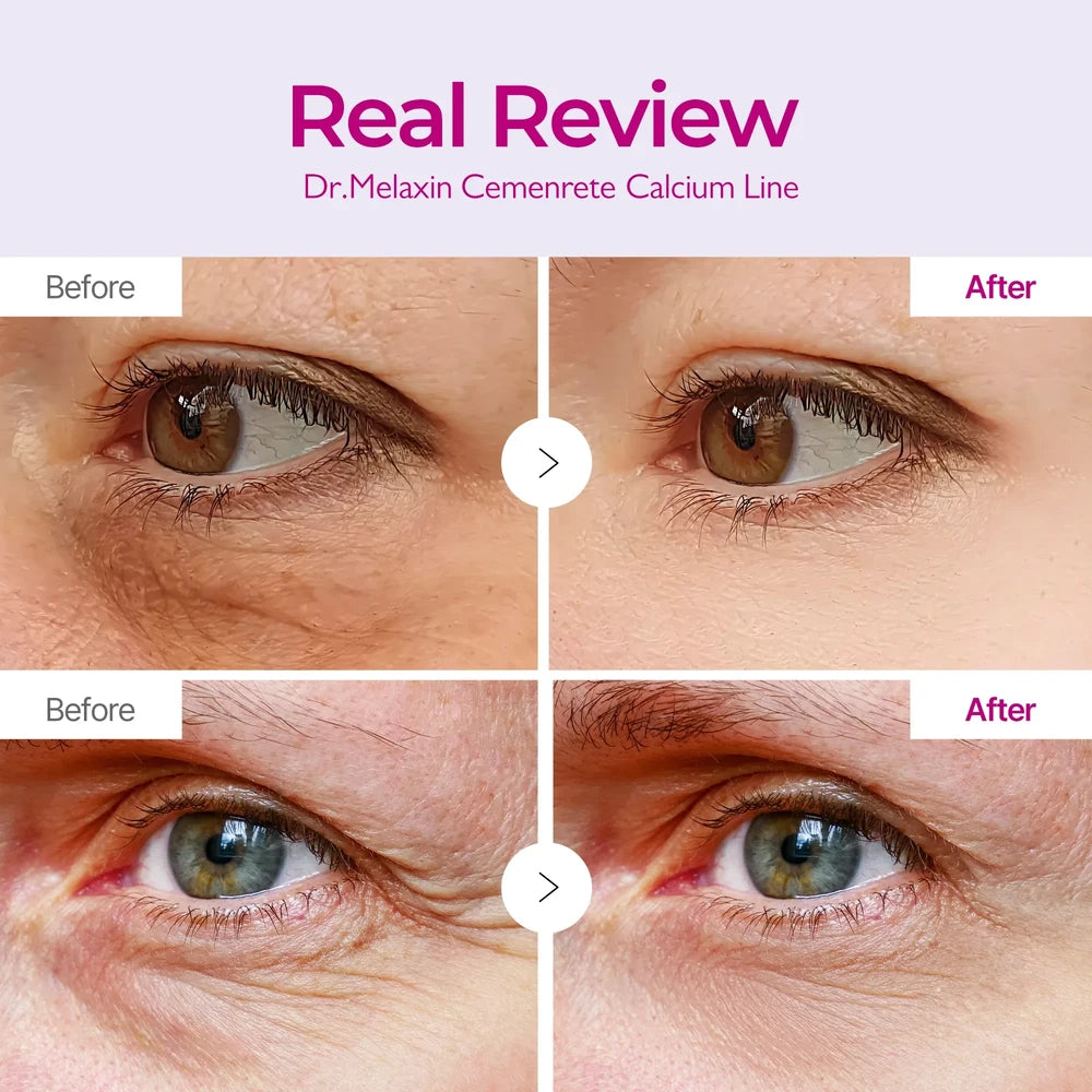 Dr. Melaxin - Cemenrete Calcium Volume Eye Patch (60 stk)